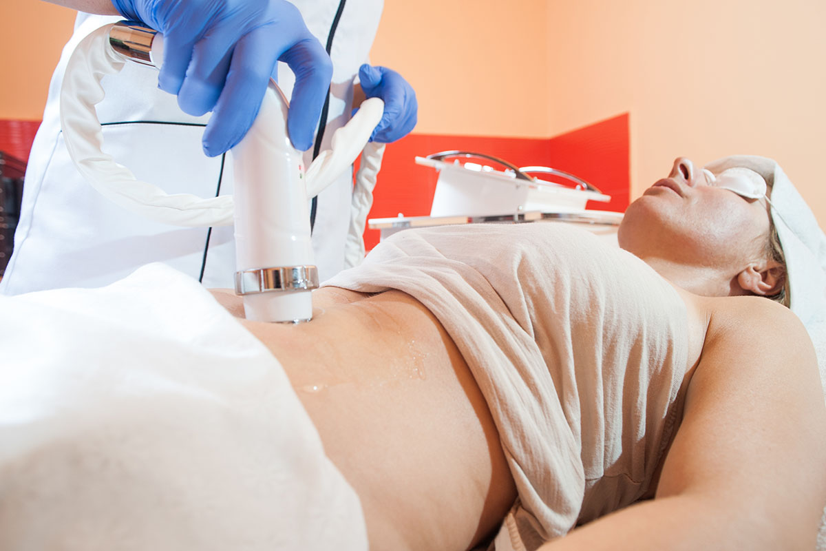 Latest CoolSculpting Technology